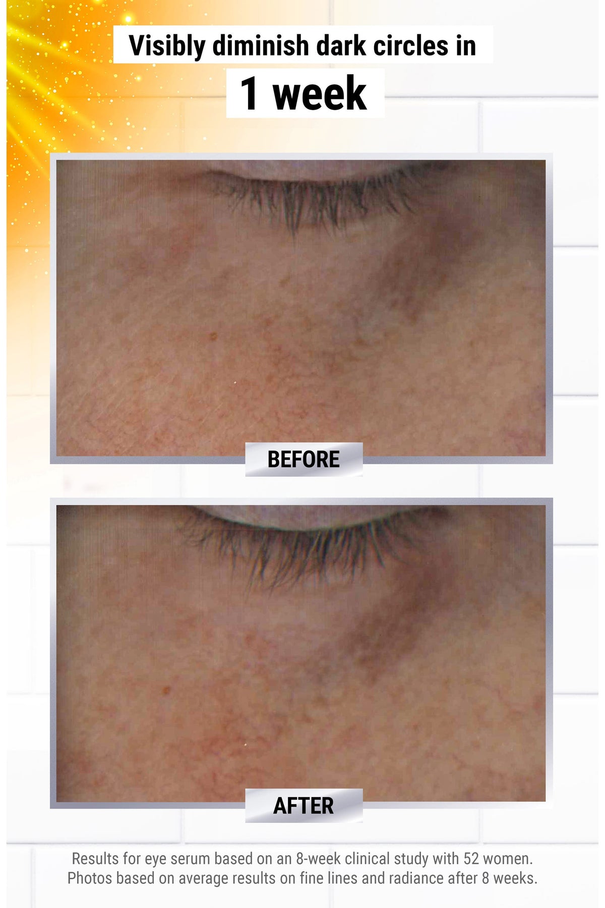 Kiehl's Powerful-Strength Eye Serum with 10% Pure Vitamin C, Tri-Peptide & Hyaluronic Acid, 15 ml
