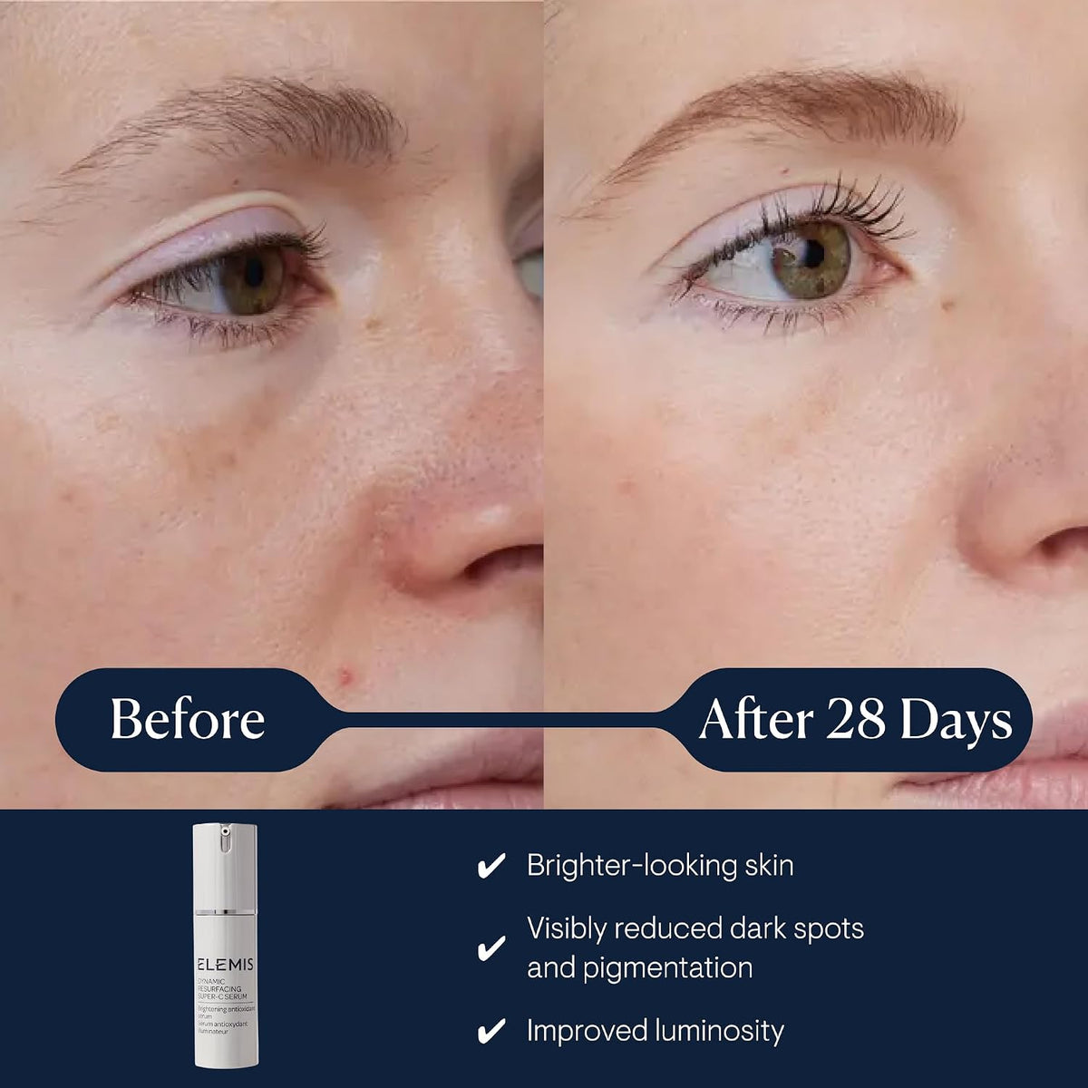 ELEMIS Dynamic Resurfacing Gel Mask 50ml | Tri-Enzyme Skin Smoothing Treatment with Acerola Cherry for Brighter, Radiant-Looking Skin