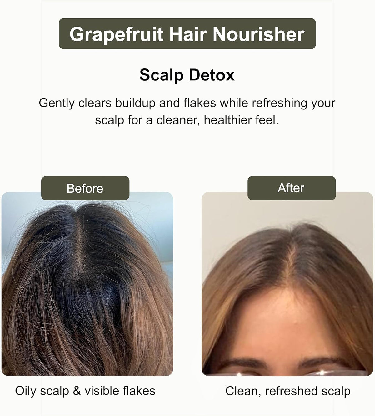 Hair Fusion 3-Pack Hair Oil Set, Batana Essence Oil, Grapefruit Hair Nourisher & Rosemary Growth Elixir, 120 ml Each (Total 360 ml)