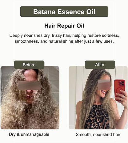 Hair Fusion 3-Pack Hair Oil Set, Batana Essence Oil, Grapefruit Hair Nourisher & Rosemary Growth Elixir, 120 ml Each (Total 360 ml)